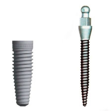 mini implants, which are affordable dental implants