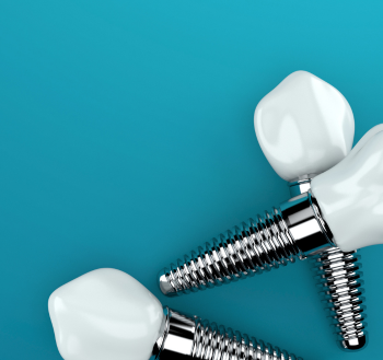 Three dental implants placed close together