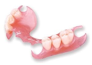 Valplast partial denture for replacing lower front teeth